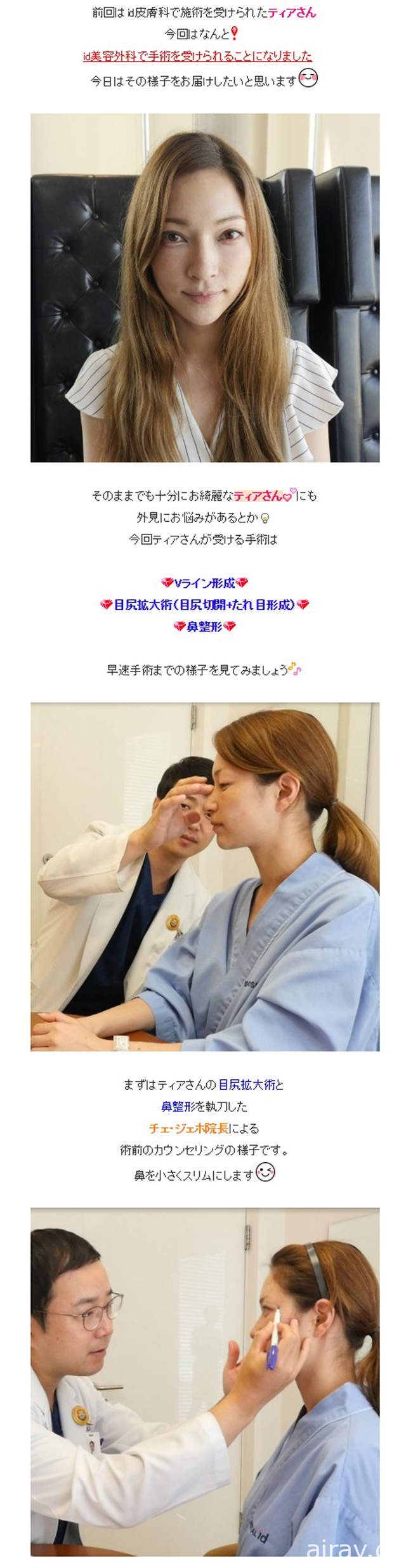 混血AV女優蒂亞《自爆跑去整形了》原本已經夠漂亮了有必要整嗎……